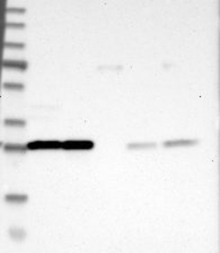NBP1-90337 - 14-3-3 protein theta